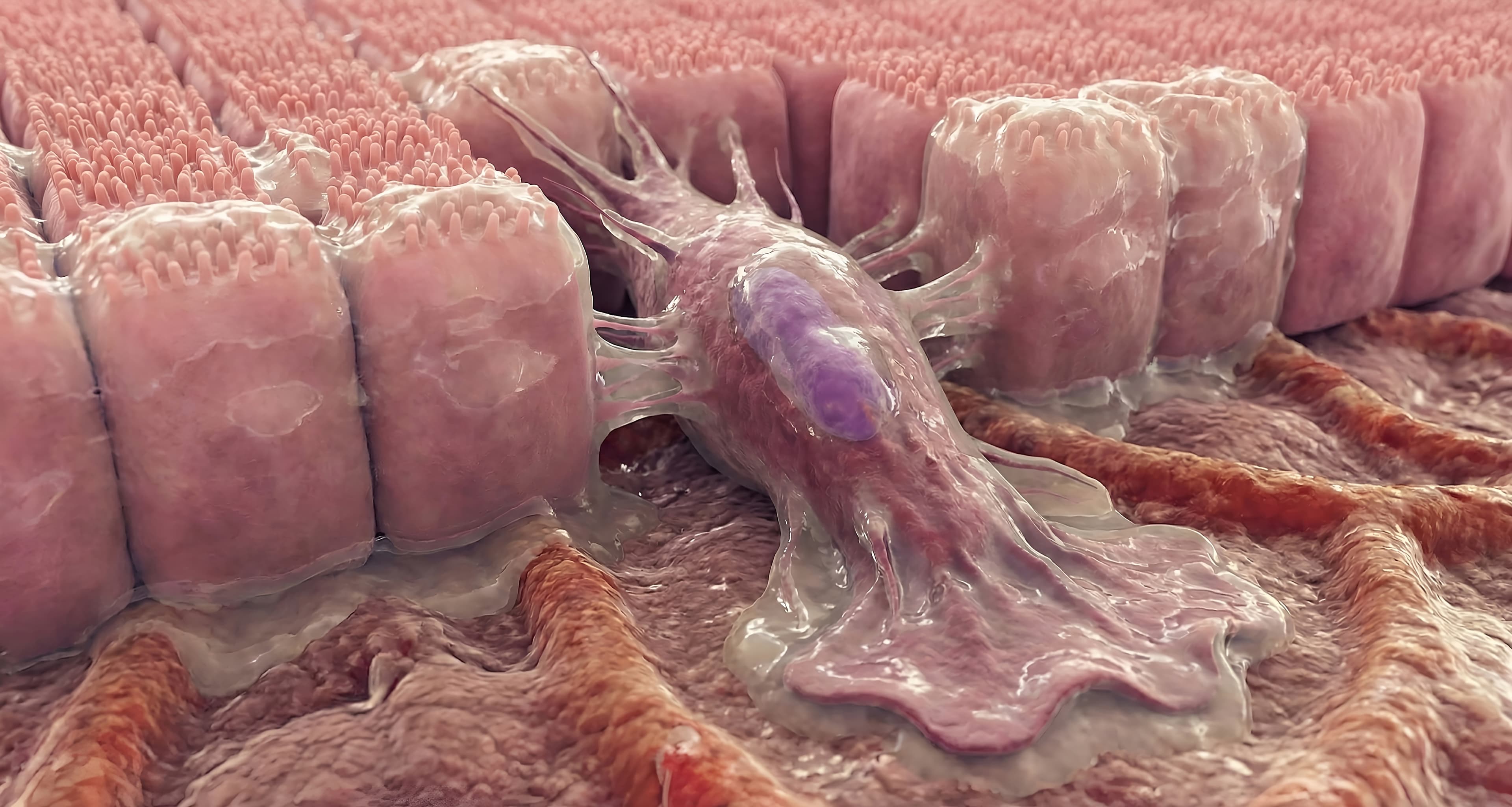 Regime perioperatório com imunoterapia é aprovado para o câncer gástrico e da junção gastroesofágica no Brasil