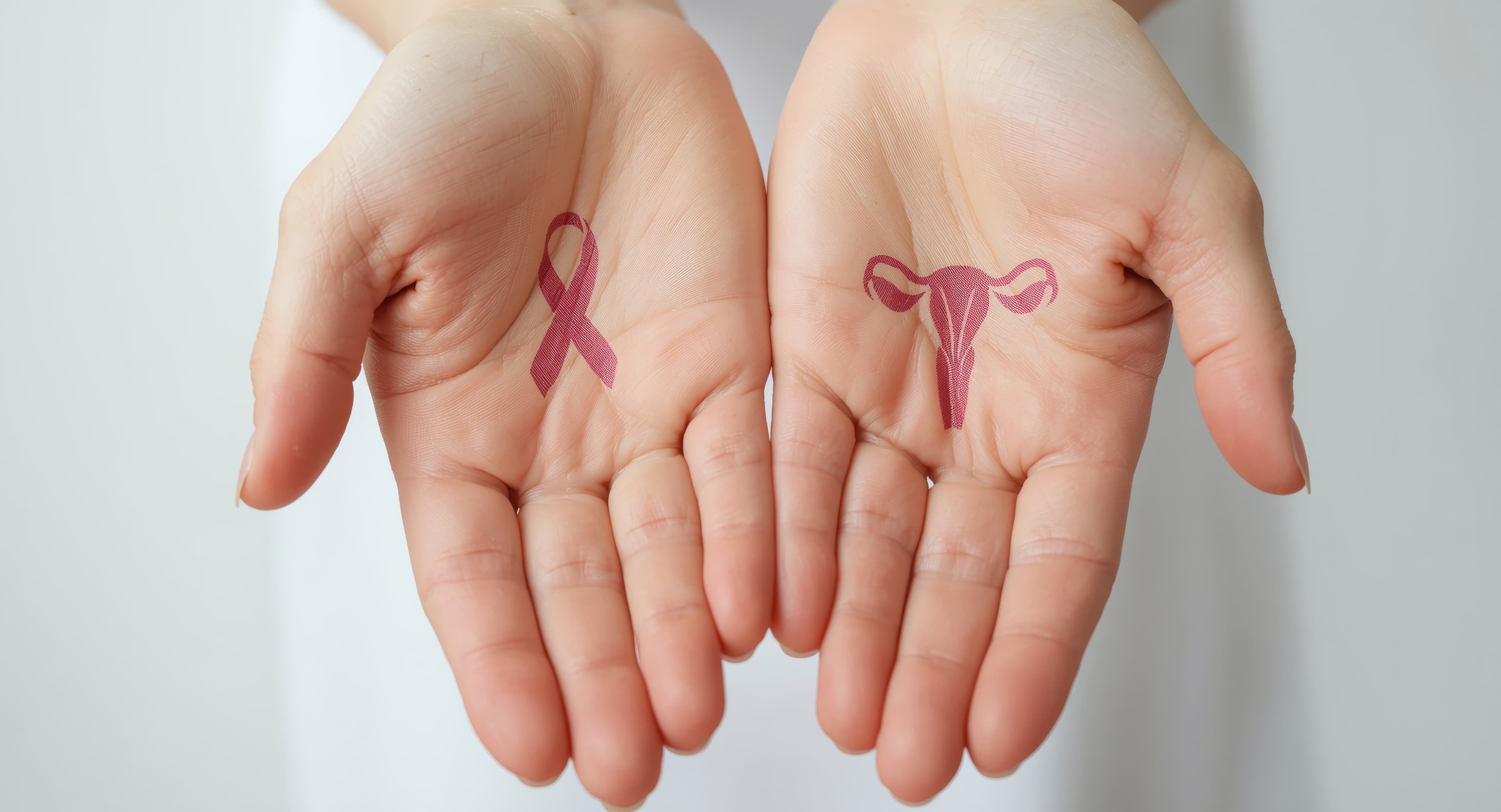 Antagonista do receptor de glicocorticoide é aprovado em combinação com quimioterapia para o carcinoma de ovário resistente à platina