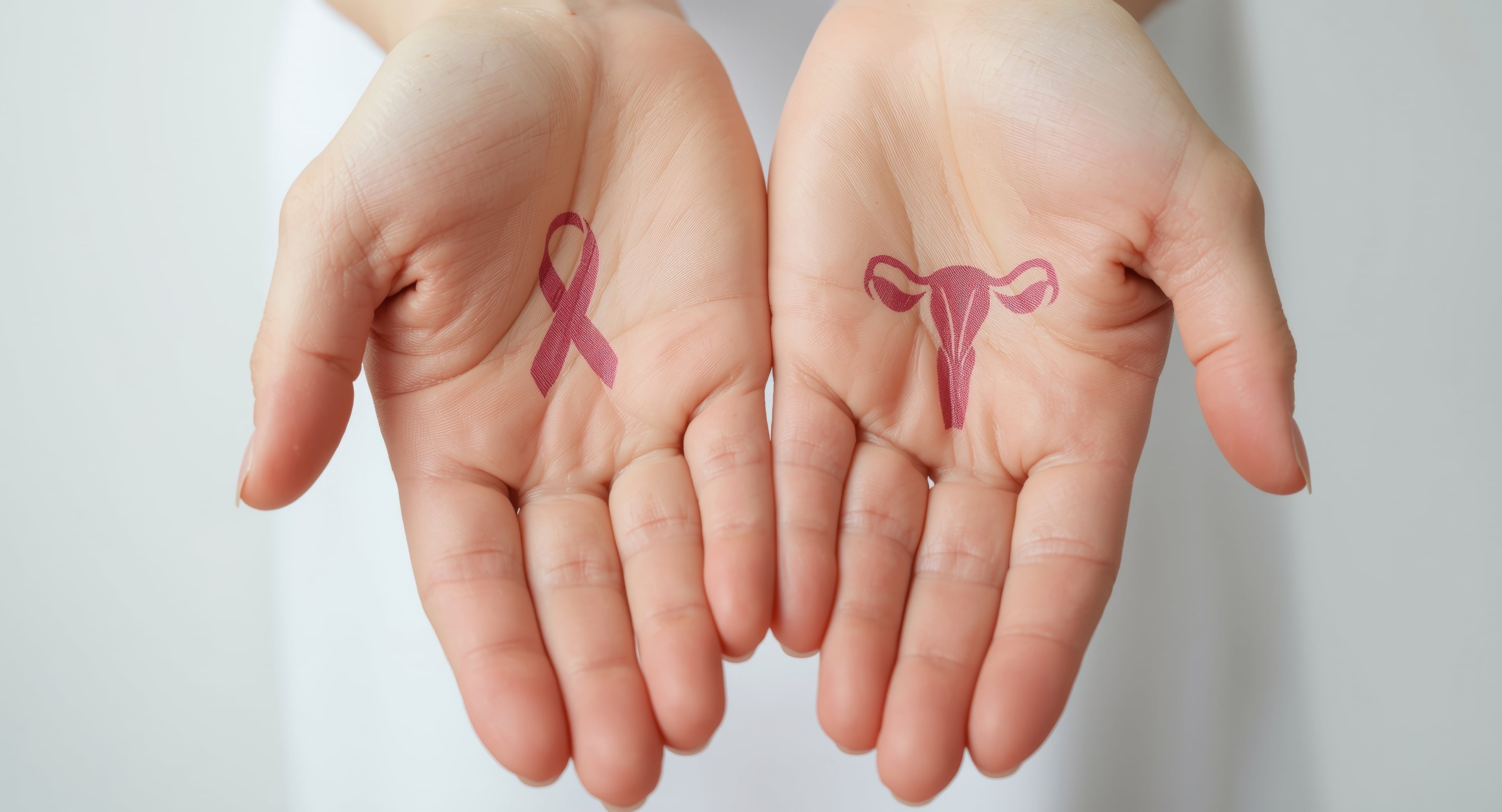 Antagonista do receptor de glicocorticoide é aprovado em combinação com quimioterapia para o carcinoma de ovário resistente à platina