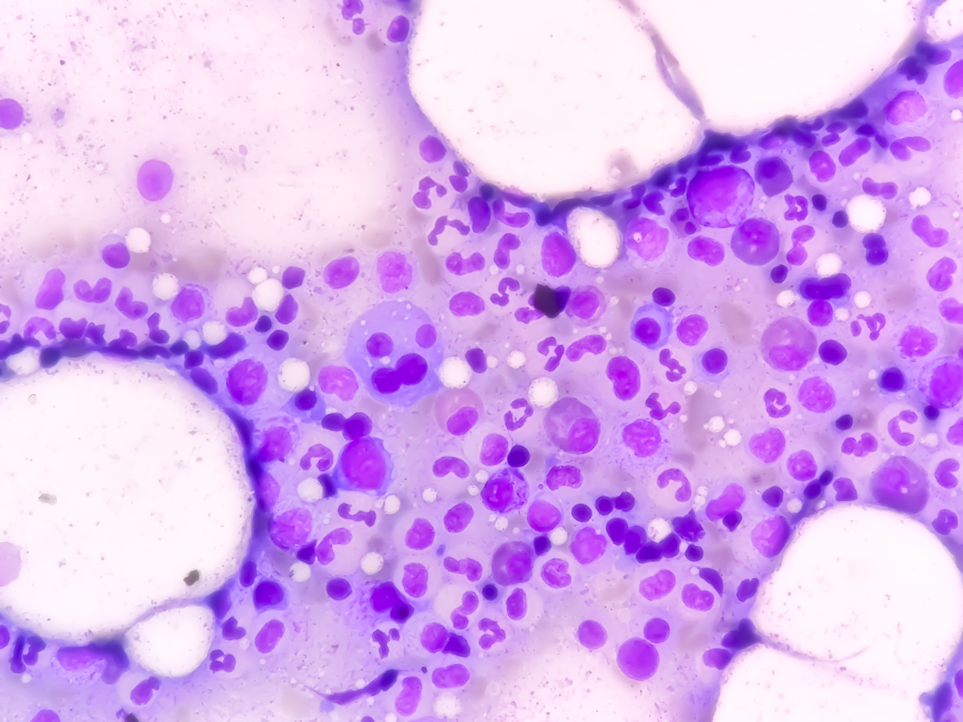 Image alternative text